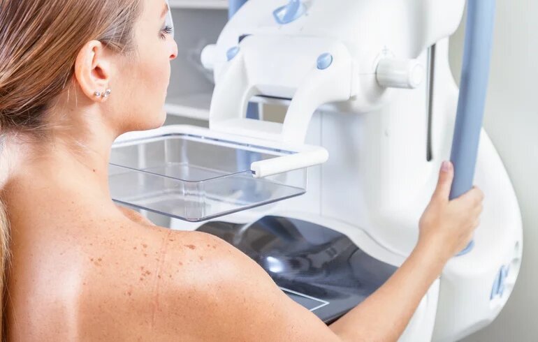 Mammográfiai vizsgálat