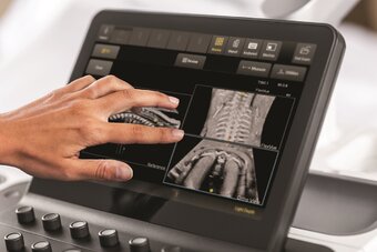 TouchView_1150_FlexVueOrtho_sm_1.jpg
