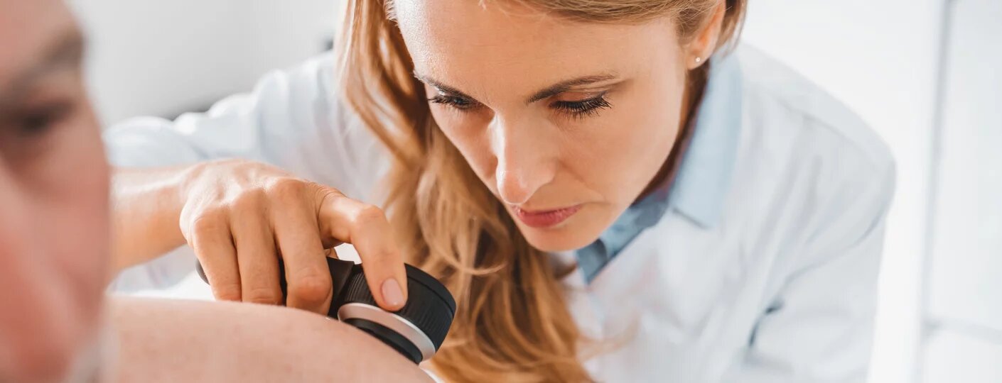 Mole screening with discount